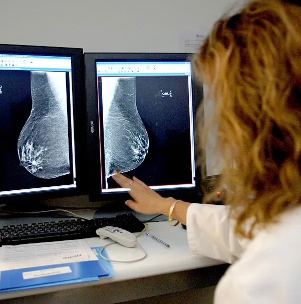 Sanidad amplía el cribado de cáncer de mama a mujeres de 45 a 74 años en todo el país