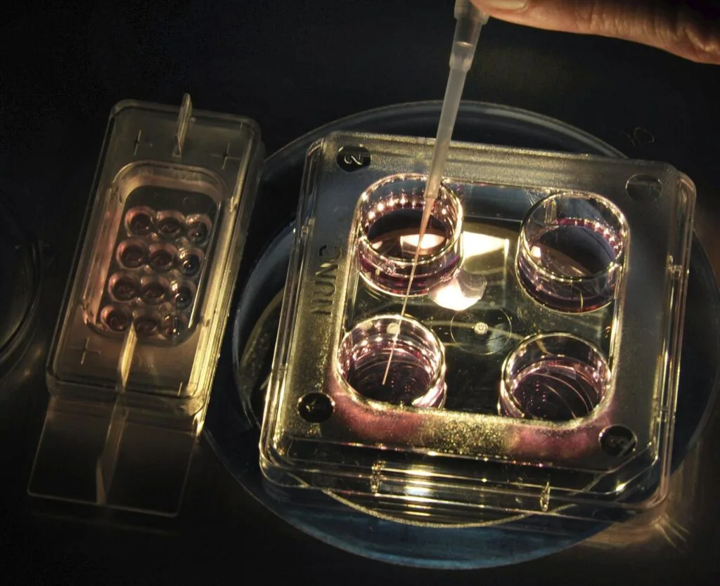 Brote de salmonelosis afecta a cerca de 90 personas en colegio privado de Madrid