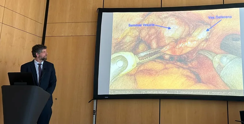 Prostatectomía robótica Retzius-Sparing mejora función urinaria y sexual en cáncer de próstata