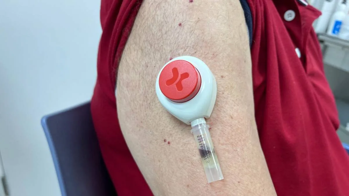 Evaluan en Cataluña técnica de microextracción para muestras de sangre menos invasivas